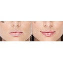 FacEvolution LipPlus Lip Booster Lipgloss für volle und sinnliche Lippen 5 ml